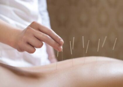 Acupuncture et PMA : retrouver équilibre et sérénité