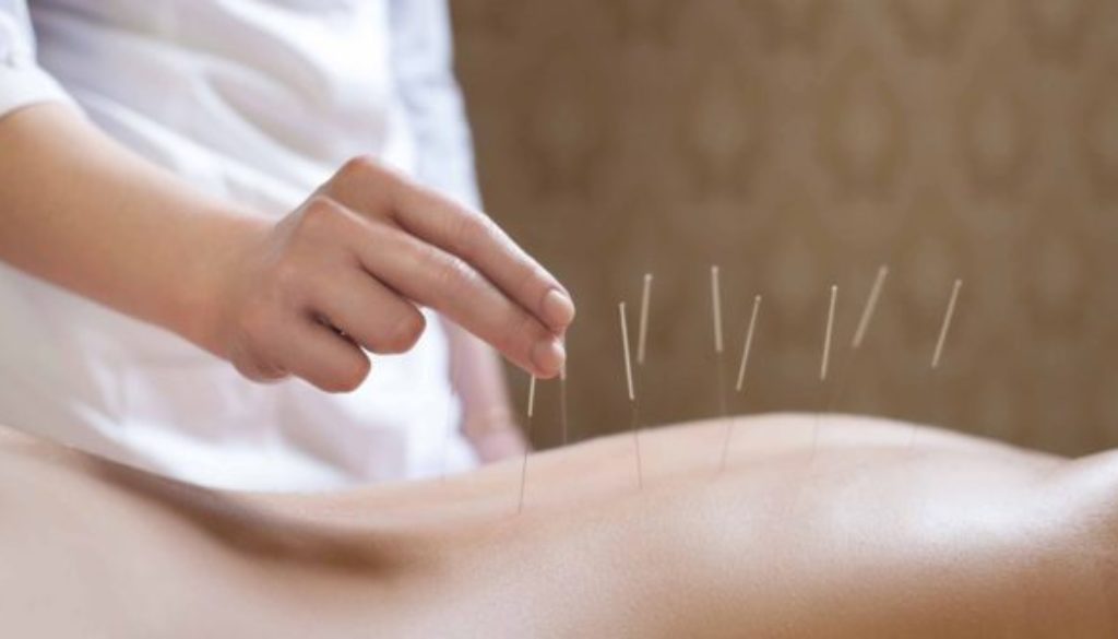 acupuncture nantes